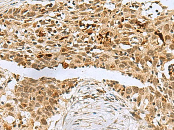 BCL7B Polyclonal Antibody - image 1