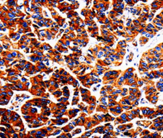ADD1 Polyclonal Antibody - image 1