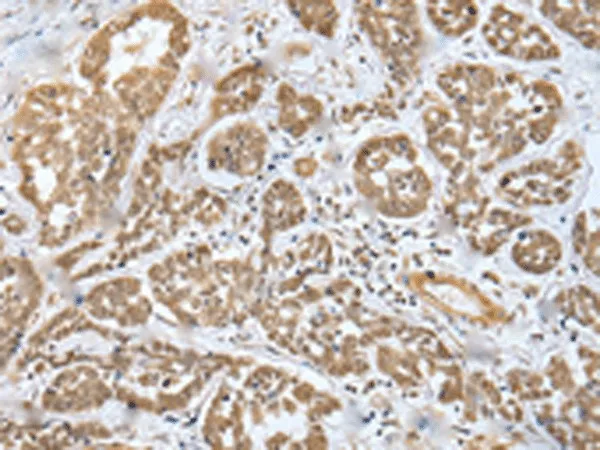 MOB4 Polyclonal Antibody - image 2