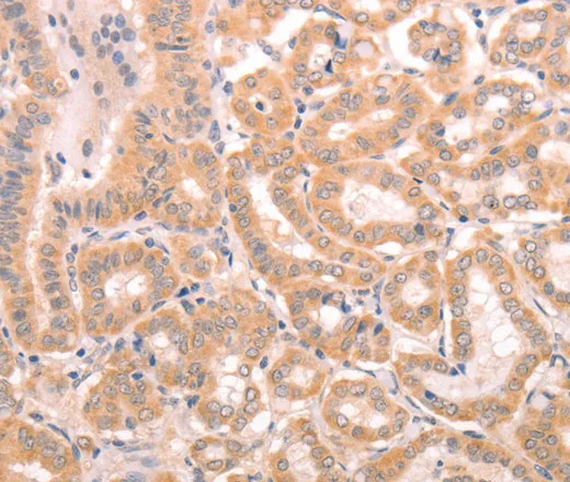 TRPC3 Polyclonal Antibody - image 1