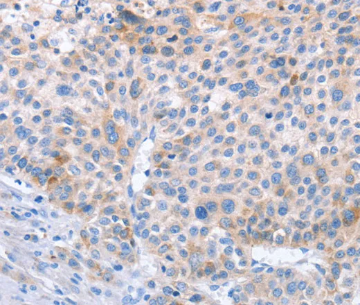 STK4 Polyclonal Antibody - image 1