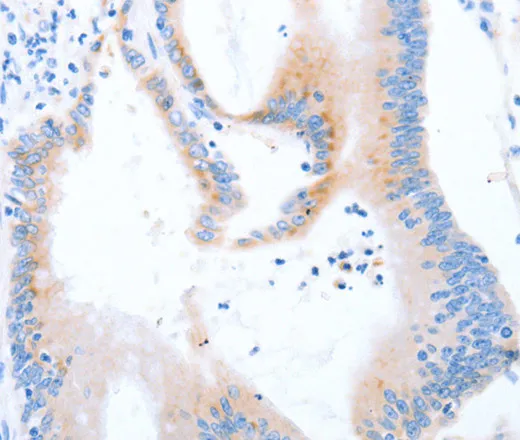 STK4 Polyclonal Antibody - image 2