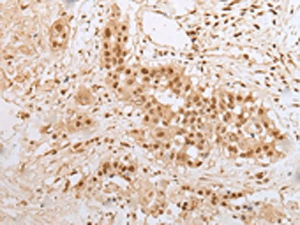 ZNF22 Polyclonal Antibody - image 1