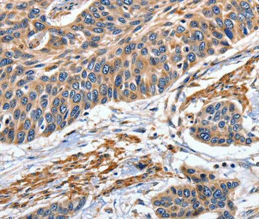 EFNB2 Polyclonal Antibody - image 1