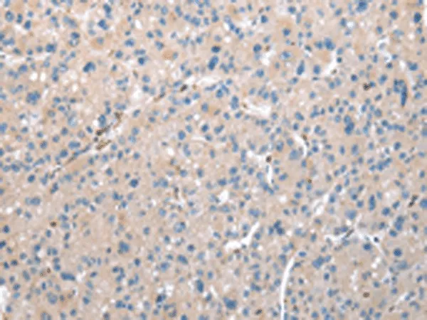 DCAF7 Polyclonal Antibody - image 1