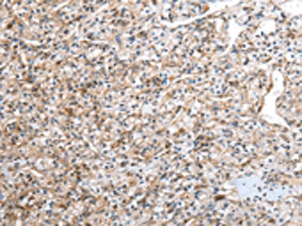 DCAF7 Polyclonal Antibody - image 2