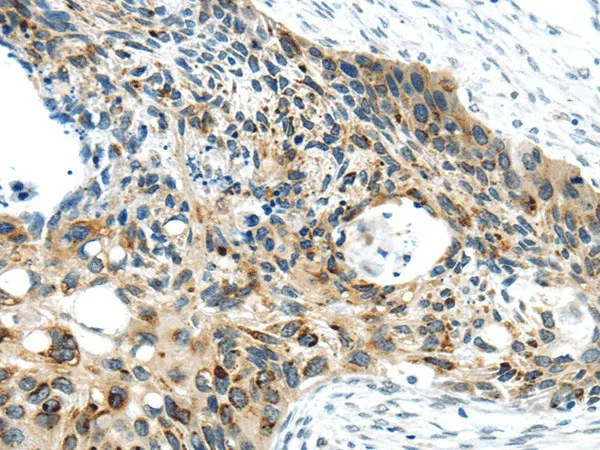 VAMP2 Polyclonal Antibody - image 1