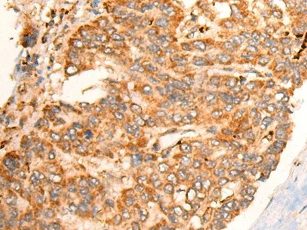 BPGM Polyclonal Antibody - image 1