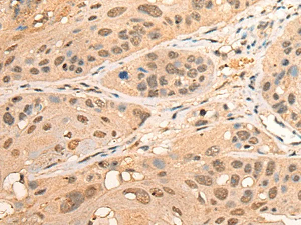 BPGM Polyclonal Antibody - image 2
