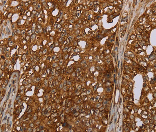 ERRFI1 Polyclonal Antibody - image 1