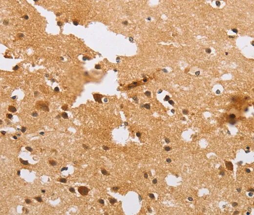 ACTR2 Polyclonal Antibody - image 1