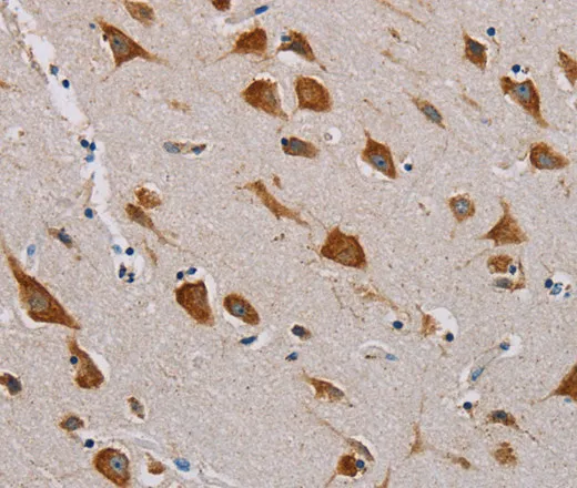 CMC4 Polyclonal Antibody - image 1