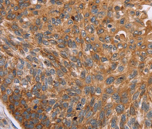 PMPCB Polyclonal Antibody - image 1