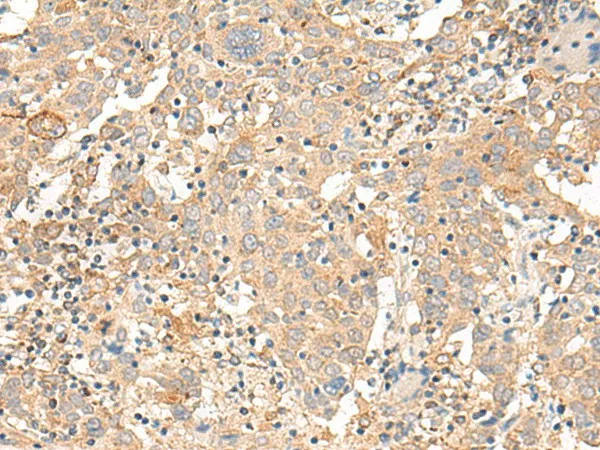 CORO2A Polyclonal Antibody - image 1