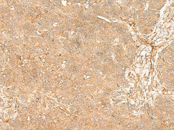 FLNC Polyclonal Antibody - image 1