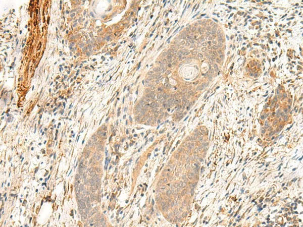 FLNC Polyclonal Antibody - image 2