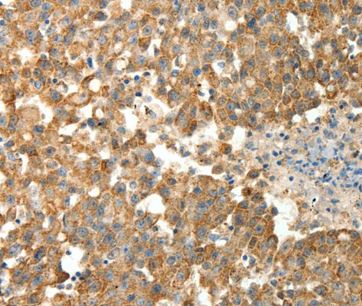 PRDX3 Polyclonal Antibody - image 1