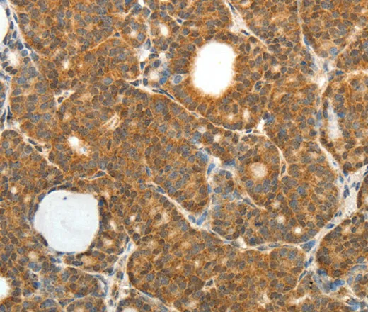 PRDX3 Polyclonal Antibody - image 2