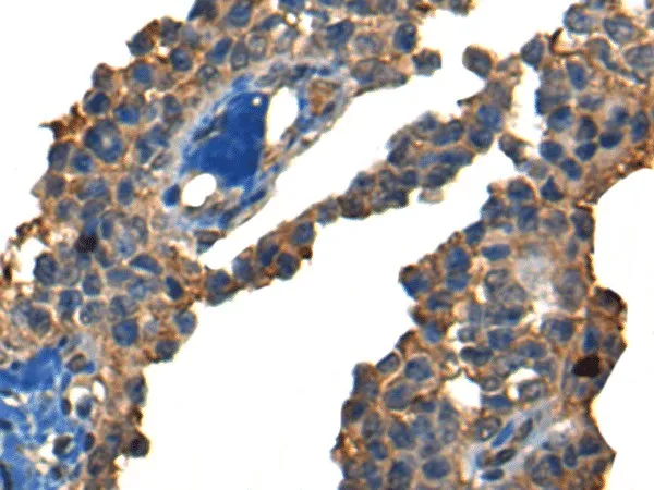 DNAJC2 Polyclonal Antibody - image 1