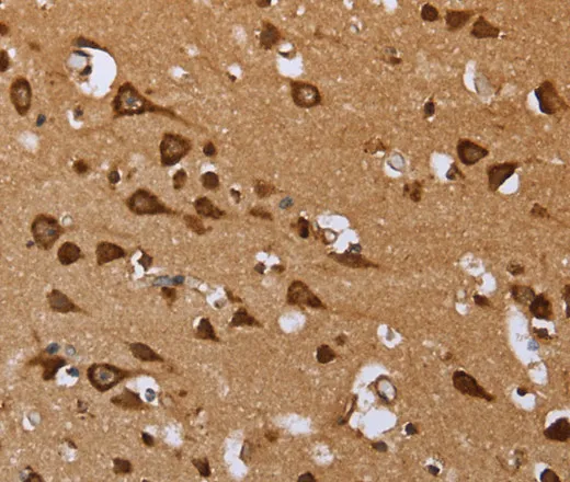 EPOR Polyclonal Antibody - image 1