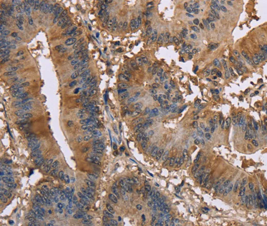 EDN2 Polyclonal Antibody - image 1