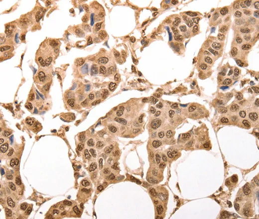 ACO2 Polyclonal Antibody - image 1
