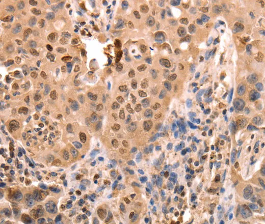ACO2 Polyclonal Antibody - image 2