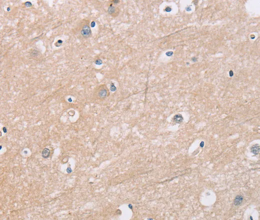KLK4 Polyclonal Antibody - image 1