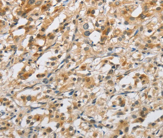 NAPSA Polyclonal Antibody - image 1