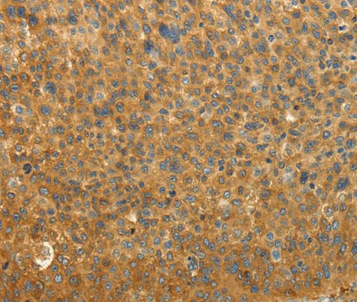 RAB35 Polyclonal Antibody - image 1