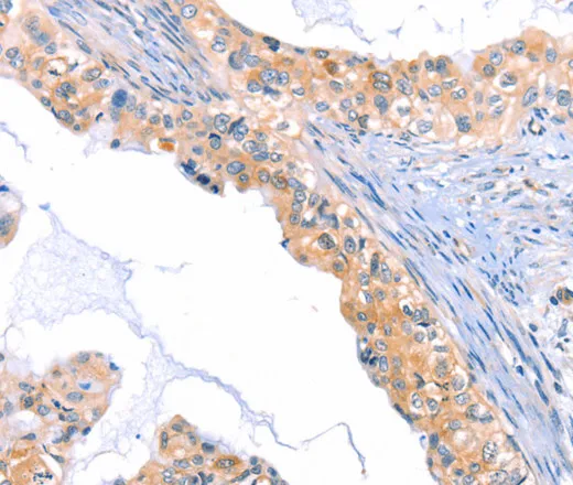 THBS1 Polyclonal Antibody - image 1