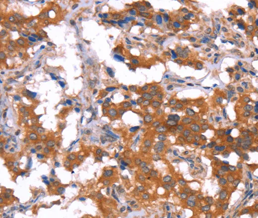 HCAR2 Polyclonal Antibody - image 1