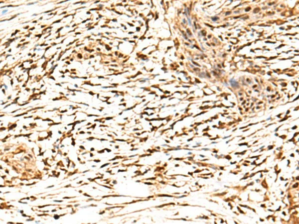 RETREG1 Polyclonal Antibody - image 1