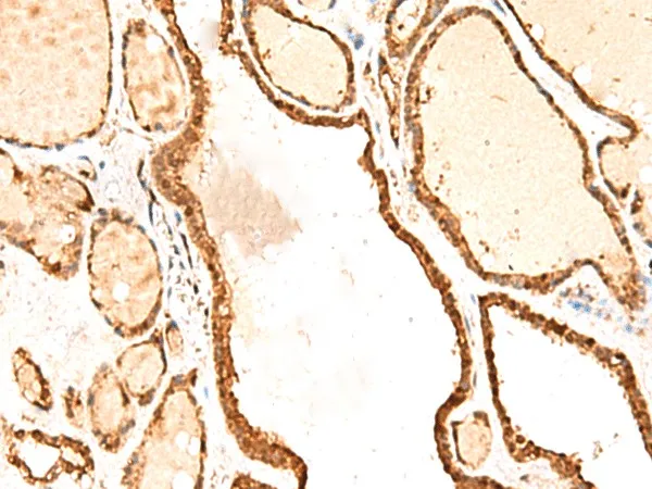 RETREG1 Polyclonal Antibody - image 2