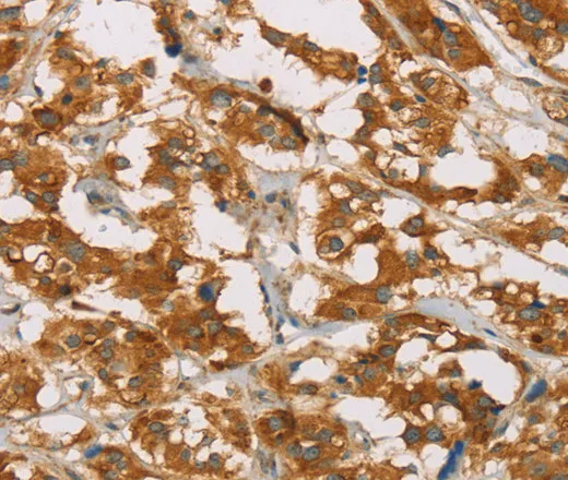 DLL4 Polyclonal Antibody - image 1