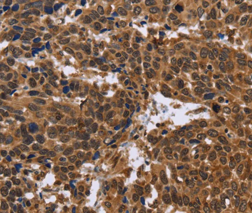 EDN2 Polyclonal Antibody - image 1