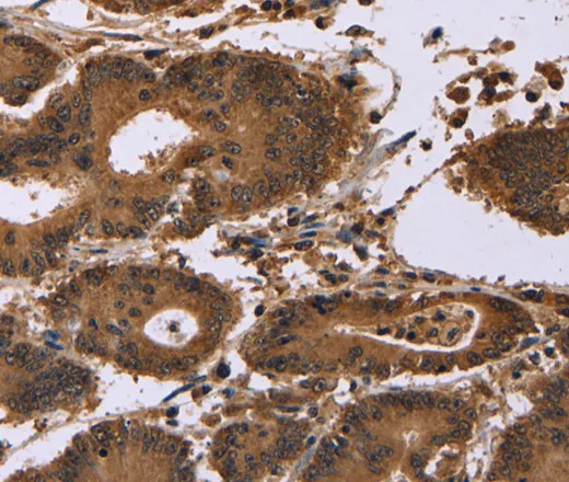 EDN2 Polyclonal Antibody - image 2