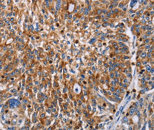 ENPP5 Polyclonal Antibody - image 1