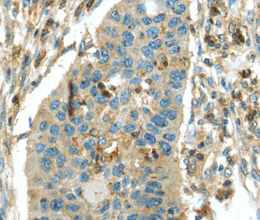 RIPK4 Polyclonal Antibody - image 1