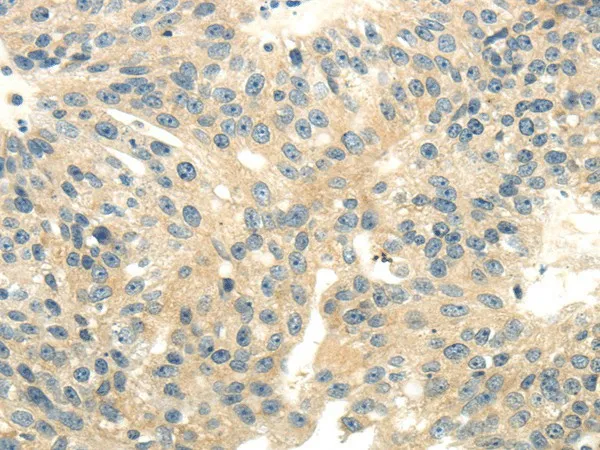 CD70 Polyclonal Antibody - image 1