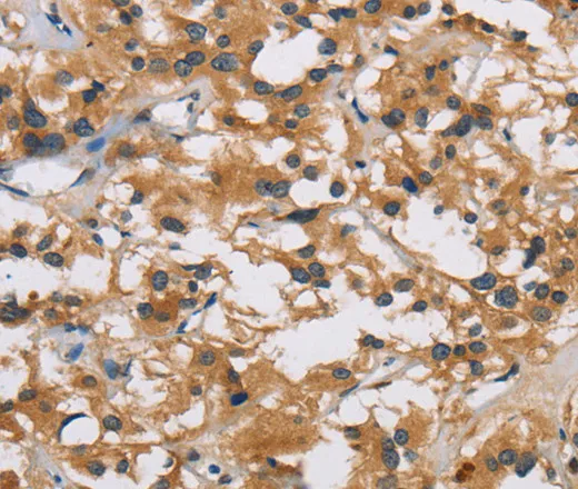 IL19 Polyclonal Antibody - image 1