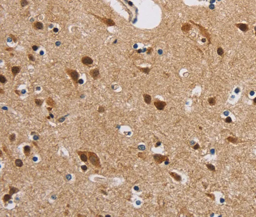 IL19 Polyclonal Antibody - image 2