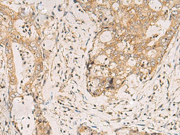 FYCO1 Polyclonal Antibody - image 1