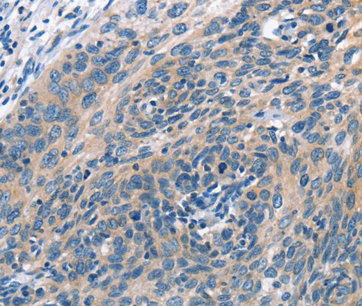 CUL7 Polyclonal Antibody - image 1
