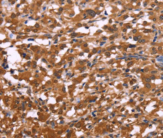 APMAP Polyclonal Antibody - image 1