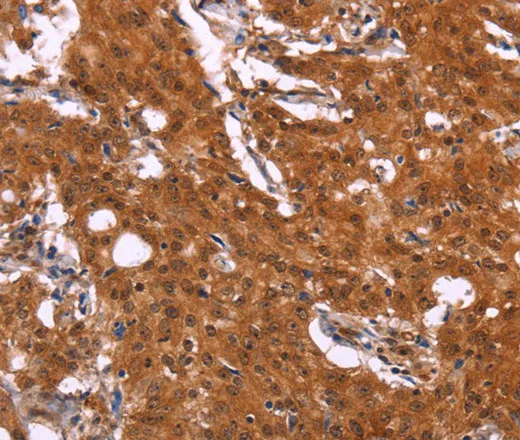 APMAP Polyclonal Antibody - image 2