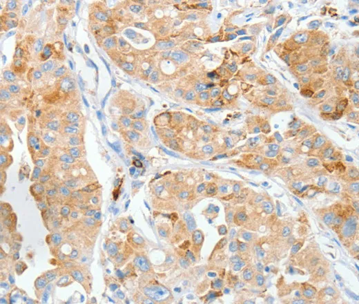 MANF Polyclonal Antibody - image 1