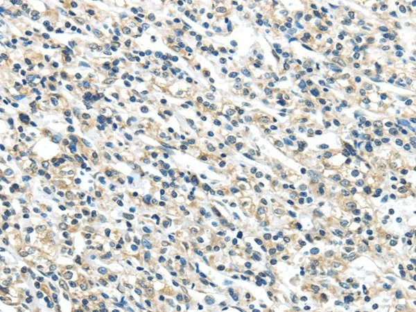 VPS36 Polyclonal Antibody - image 1