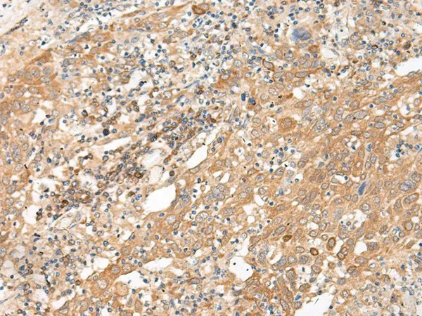 GALP Polyclonal Antibody - image 1