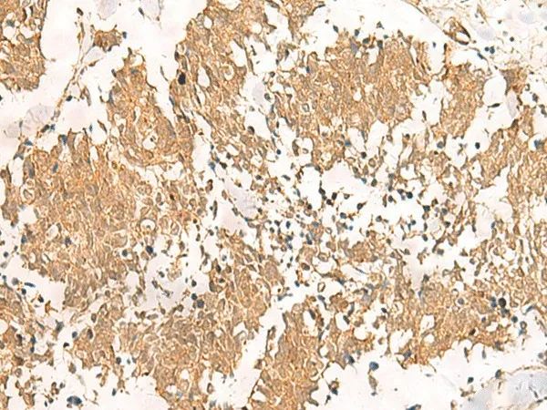 MTHFD2L Polyclonal Antibody - image 1